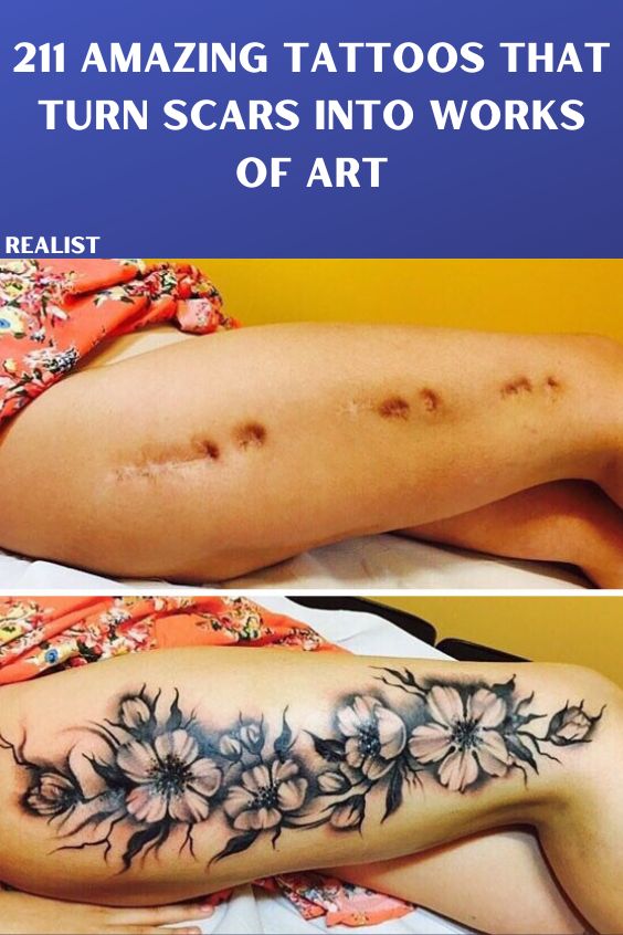 211 Amazing Tattoos That Turn Scars Into Works Of Art My Kind Of Ink