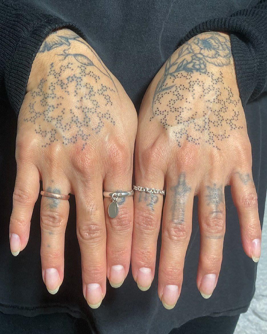 Fysal On Instagram One Hand Is Healed 1 Year And The Other Is Fresh Thank U So