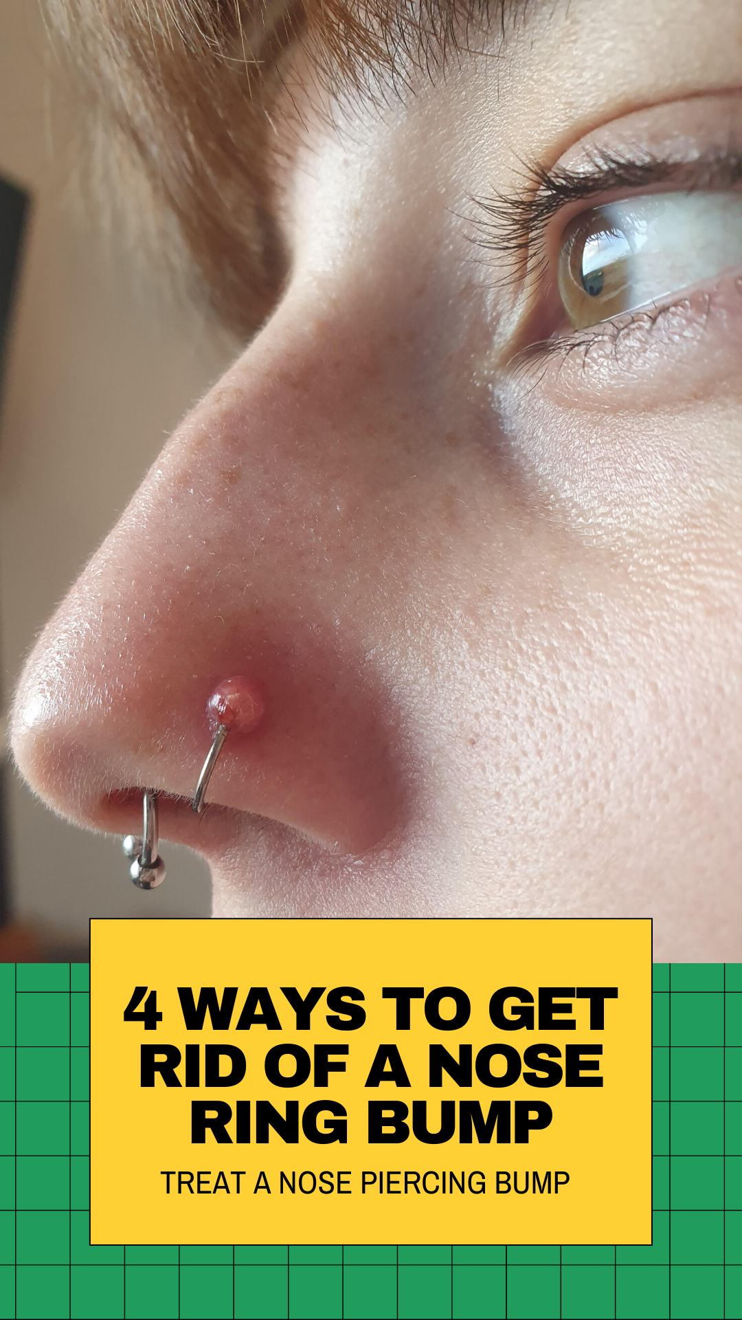 Nose Piercing Bumps Are Very Common But Also Extremely Unsightly We Delve Into The Mysteries Of