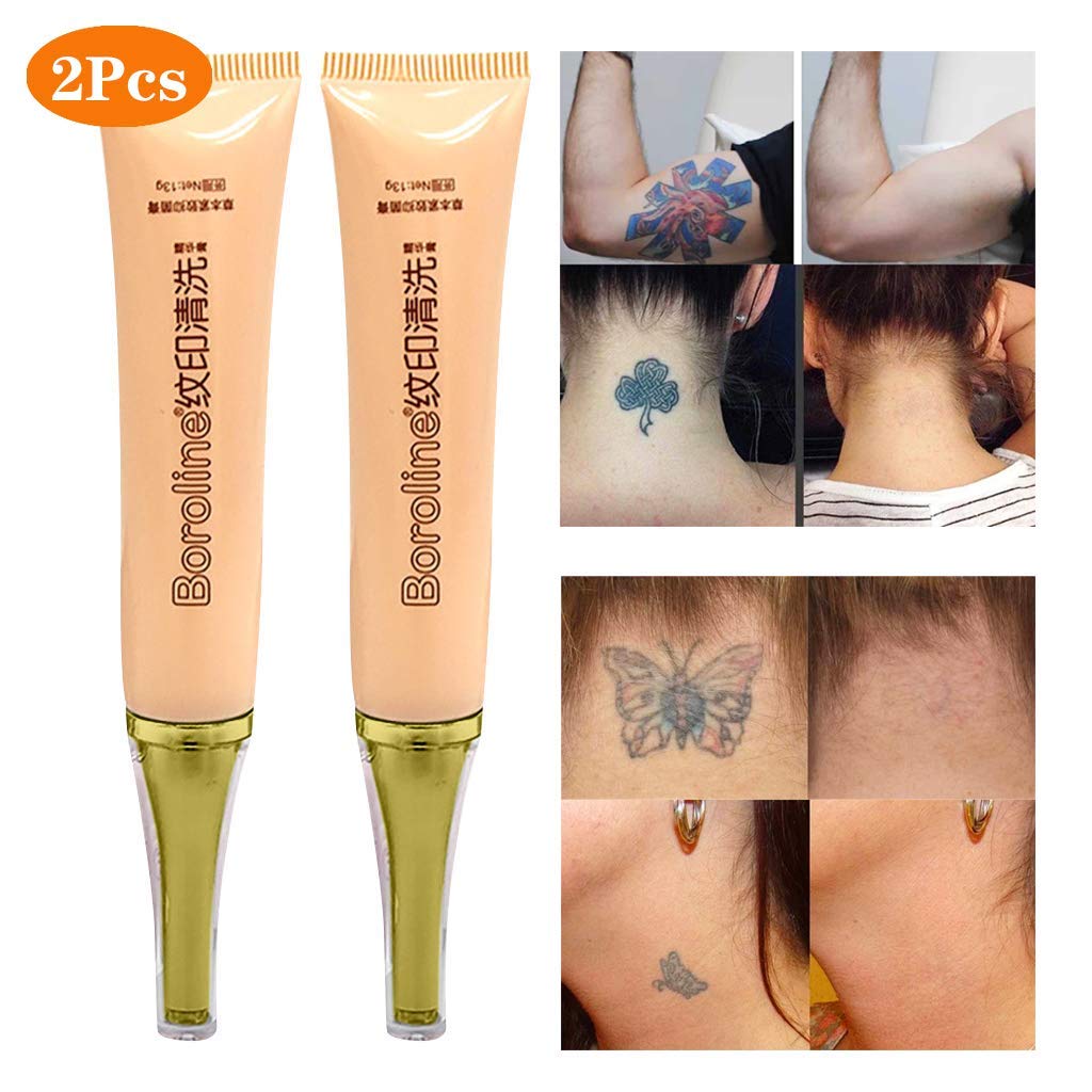 Tattoo Removal Cream Name In Home Tattoo Removal