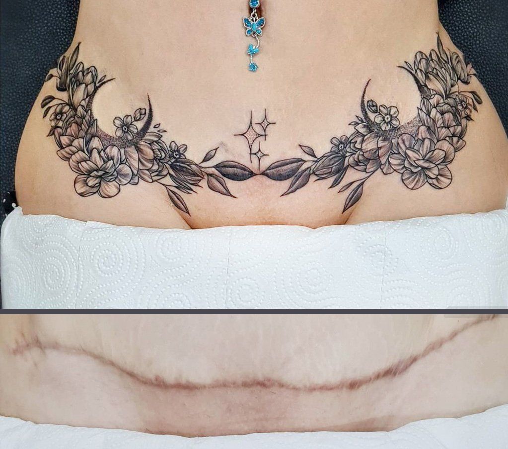 Tattoos After Tummy Tuck Image Tatuagem Tatuagens Tatoo