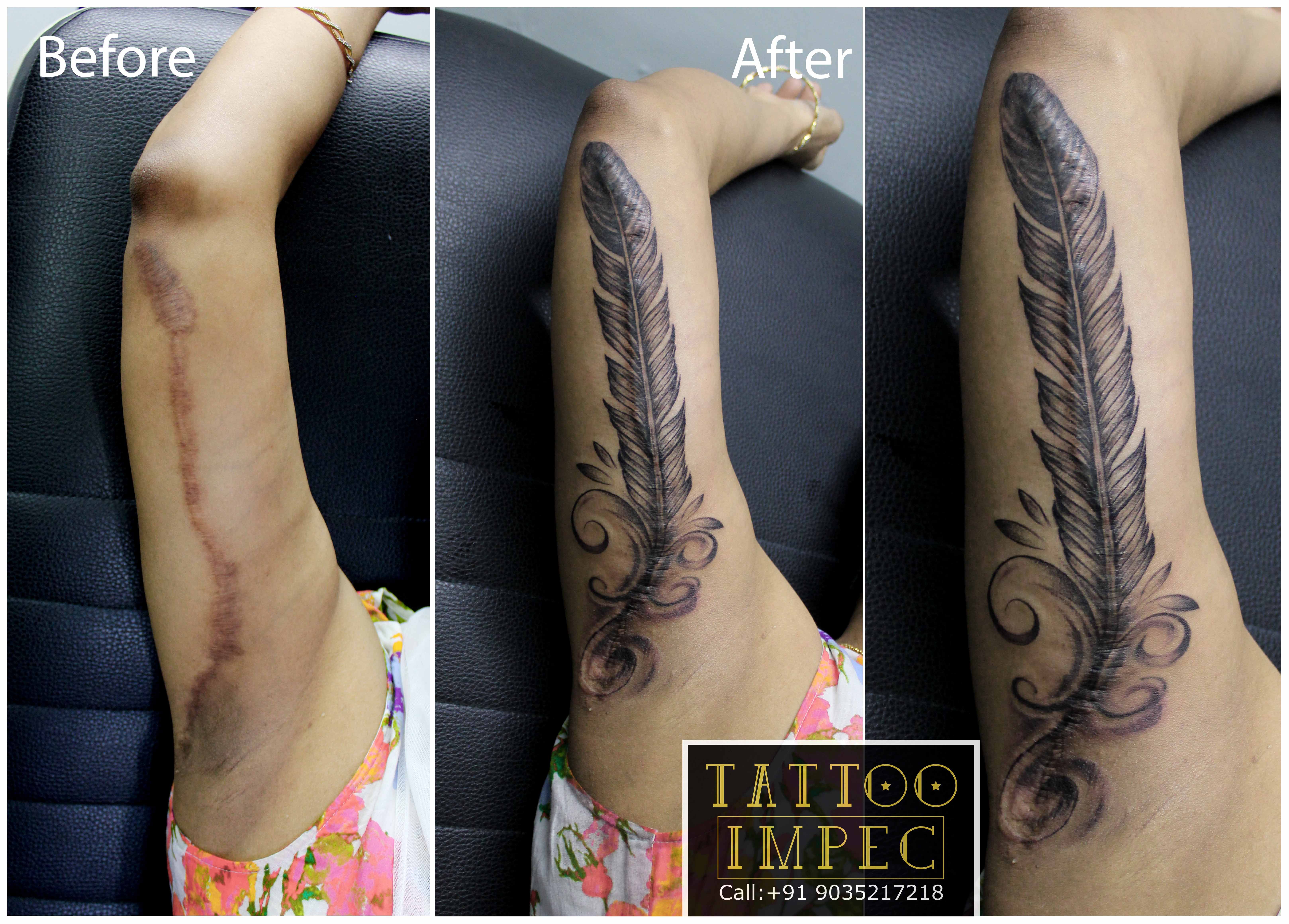 Work In Progress Scar Cover Up Tattoo Get Inked From